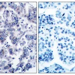 Merck Anti-TYK2 antibody produced in rabbit
