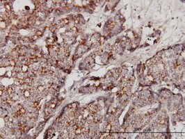 Merck MONOCLONAL ANTI-GBA