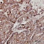 Merck MONOCLONAL ANTI-GBA