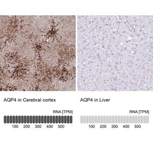 Merck ANTI-AQP4