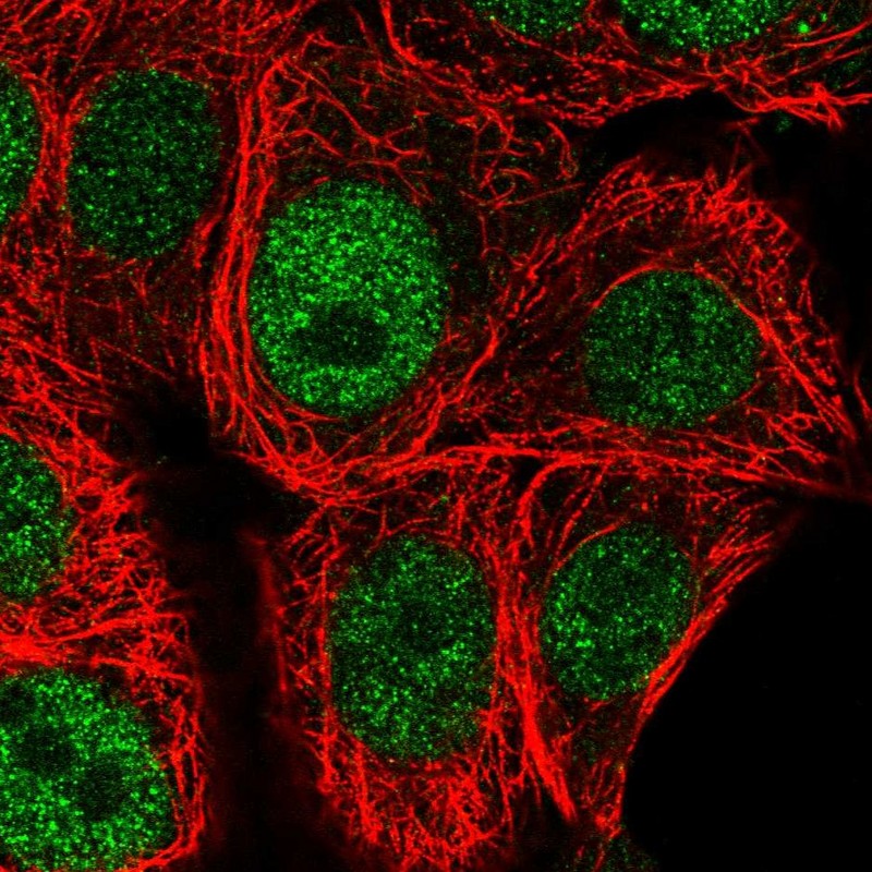 Atlas Antibodies Anti-CHEK1 Antibody