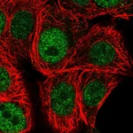 Atlas Antibodies Anti-CHEK1 Antibody