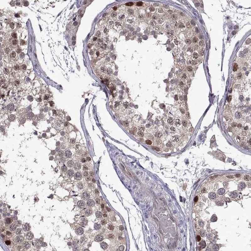 Atlas Antibodies Anti-CHFR Antibody