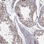 Atlas Antibodies Anti-CHFR Antibody