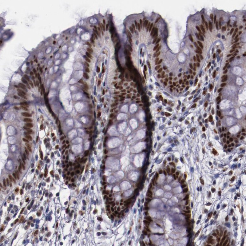 Atlas Antibodies Anti-CHEK2 Antibody