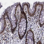 Atlas Antibodies Anti-CHEK2 Antibody