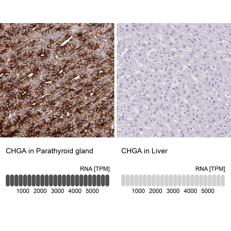 Atlas Antibodies Anti-CHGA Antibody