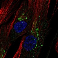 Atlas Antibodies Anti-CHI3L1 Antibody