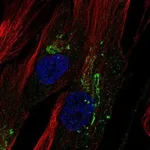 Atlas Antibodies Anti-CHI3L1 Antibody