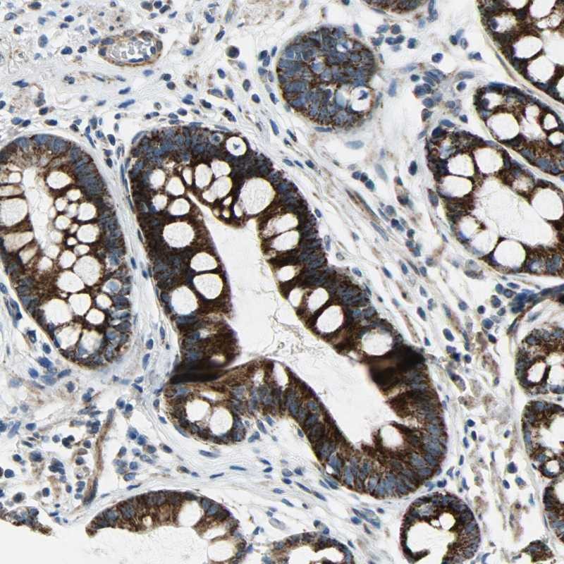 Atlas Antibodies Anti-CHI3L2 Antibody
