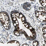 Atlas Antibodies Anti-CHI3L2 Antibody