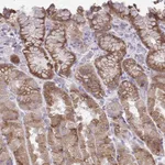 Atlas Antibodies Anti-CHIA Antibody