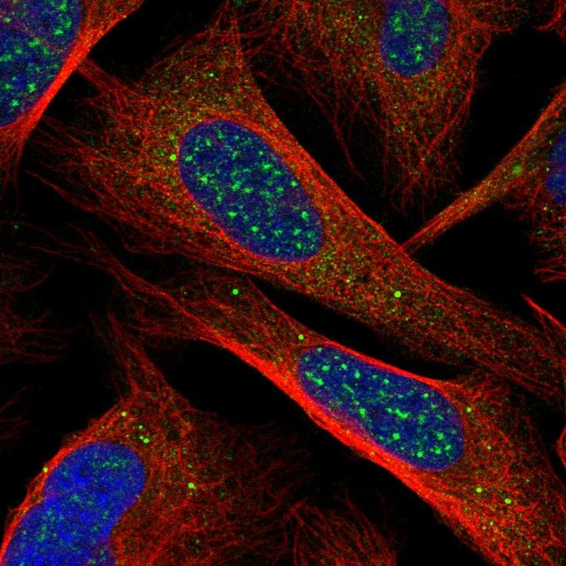 Atlas Antibodies Anti-CHIC1 Antibody