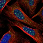 Atlas Antibodies Anti-CHIC1 Antibody