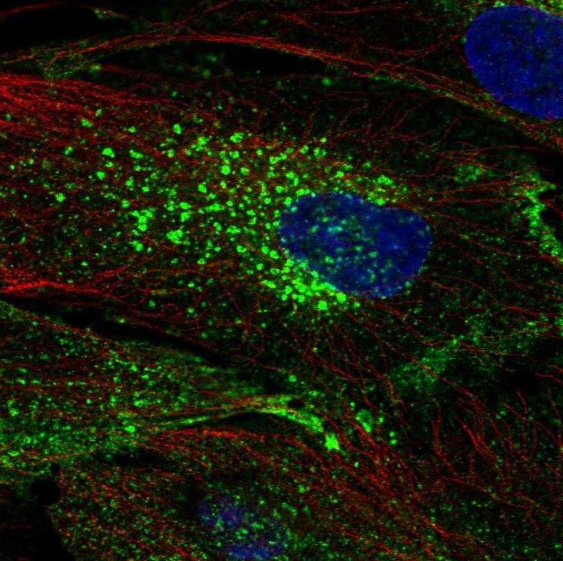 Atlas Antibodies Anti-CHIC2 Antibody