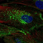 Atlas Antibodies Anti-CHIC2 Antibody