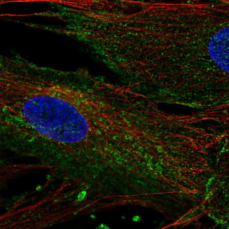 Atlas Antibodies Anti-CHIC2 Antibody