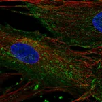 Atlas Antibodies Anti-CHIC2 Antibody