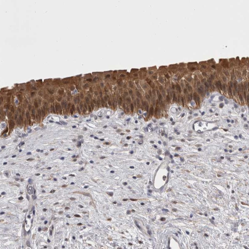 Atlas Antibodies Anti-CHIC2 Antibody