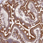 Atlas Antibodies Anti-CHID1 Antibody