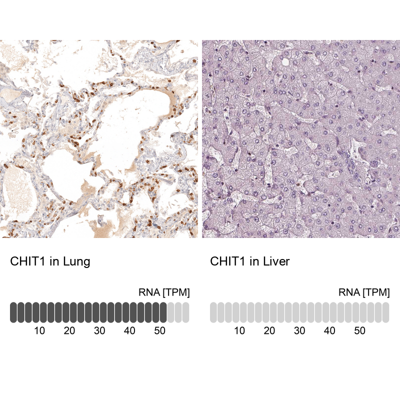 Atlas Antibodies Anti-CHIT1 Antibody