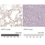 Atlas Antibodies Anti-CHIT1 Antibody