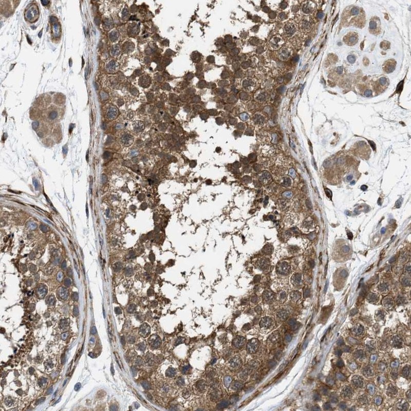 Atlas Antibodies Anti-CHKB Antibody