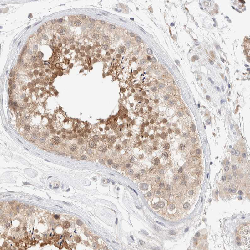 Atlas Antibodies Anti-CHKA Antibody