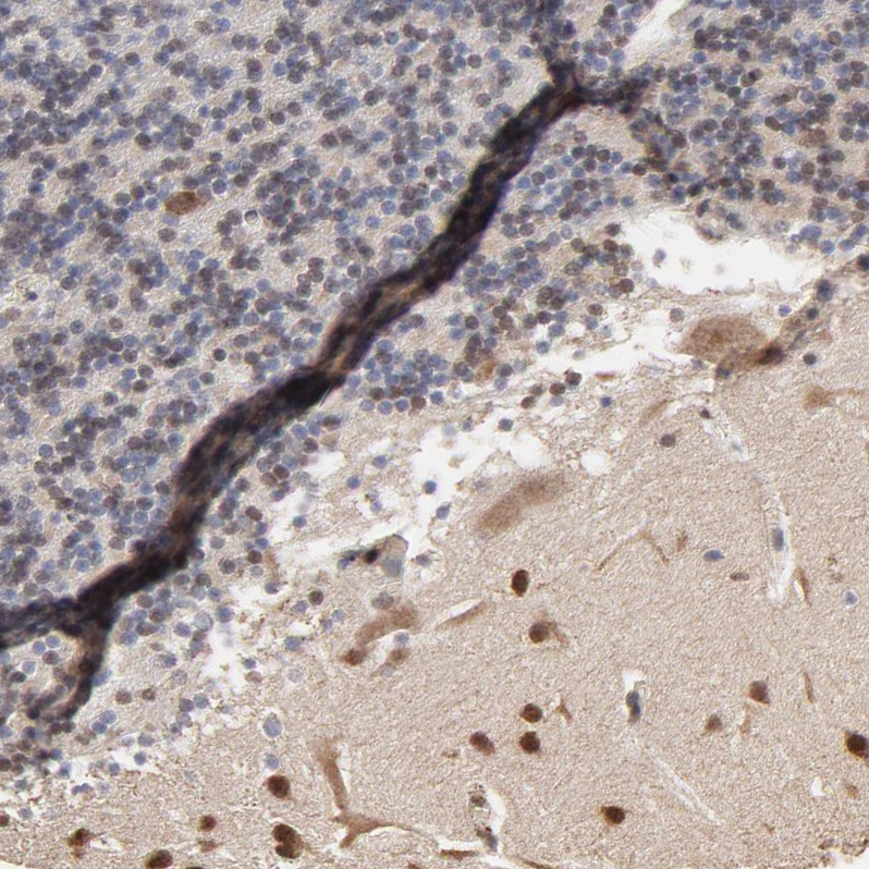 Atlas Antibodies Anti-CHM Antibody