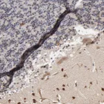 Atlas Antibodies Anti-CHM Antibody
