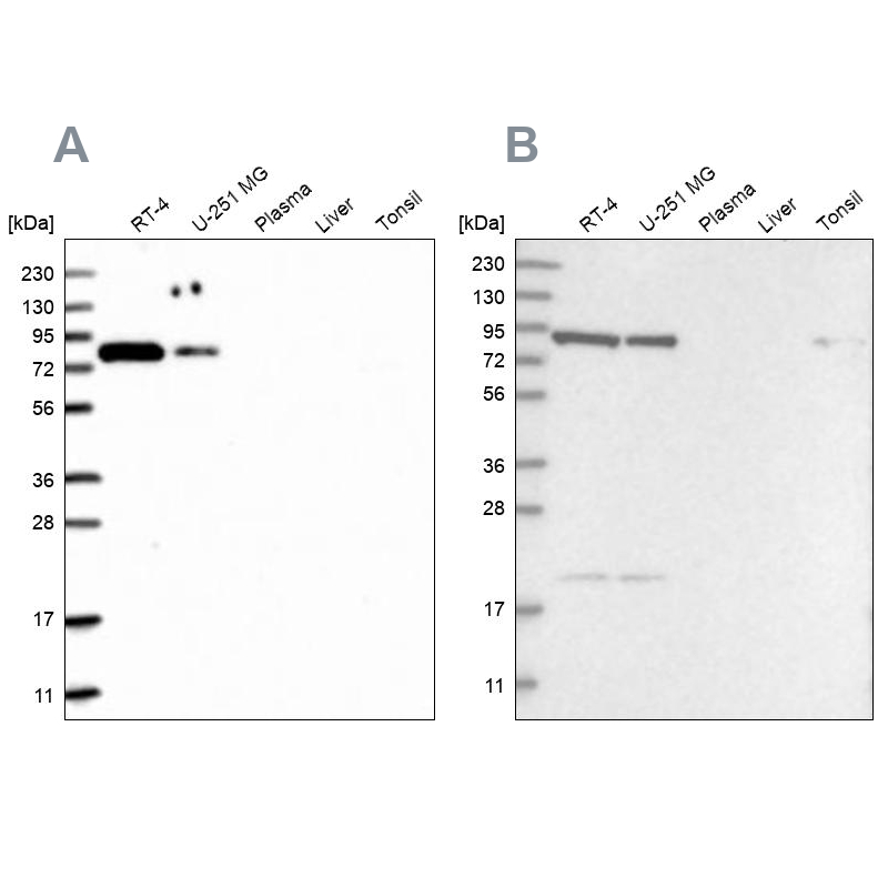 Atlas Antibodies Anti-CHML Antibody