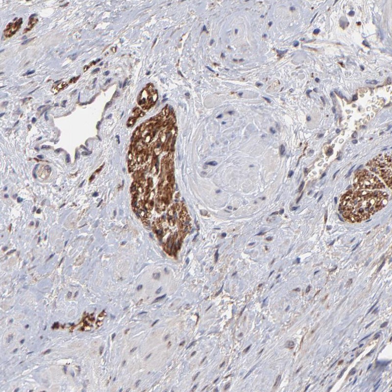 Atlas Antibodies Anti-CHL1 Antibody