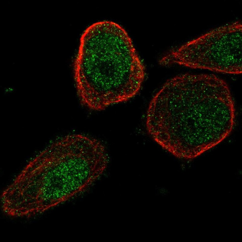 Atlas Antibodies Anti-CHML Antibody