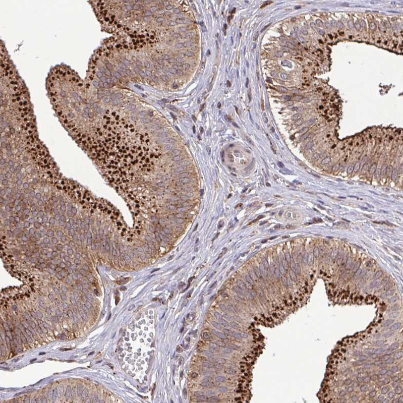Atlas Antibodies Anti-CHMP1B Antibody