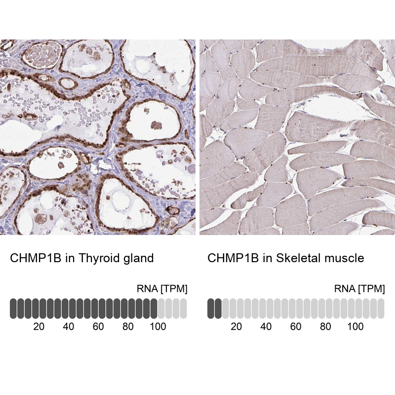 Atlas Antibodies Anti-CHMP1B Antibody