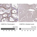 Atlas Antibodies Anti-CHMP1B Antibody