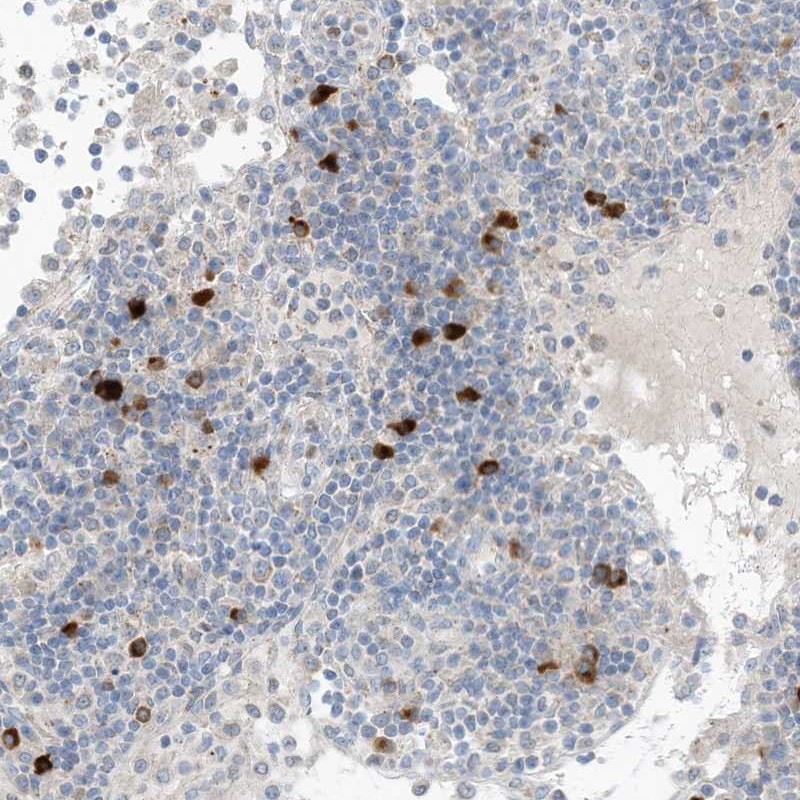 Atlas Antibodies Anti-CHMP2B Antibody