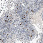 Atlas Antibodies Anti-CHMP2B Antibody