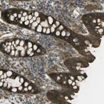 Atlas Antibodies Anti-CHMP3 Antibody