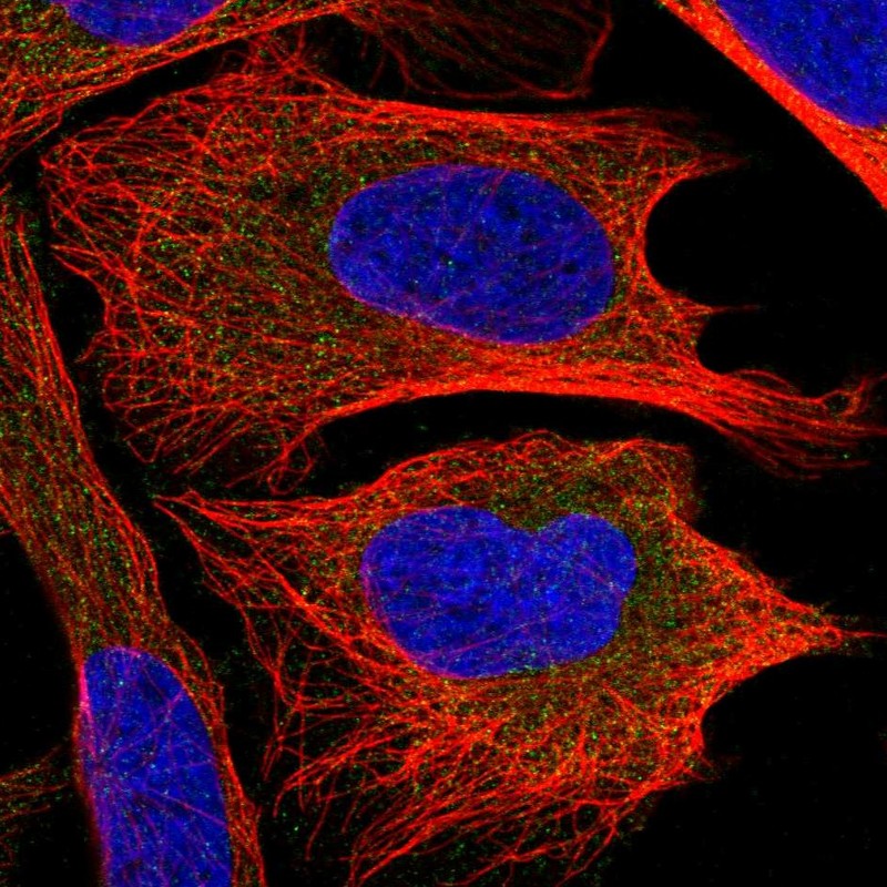 Atlas Antibodies Anti-CHMP2B Antibody