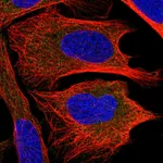 Atlas Antibodies Anti-CHMP2B Antibody