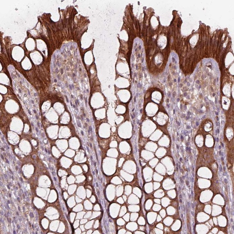 Atlas Antibodies Anti-CHMP3 Antibody