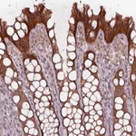 Atlas Antibodies Anti-CHMP3 Antibody