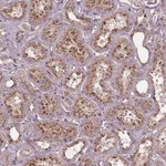 Atlas Antibodies Anti-CHMP4A Antibody