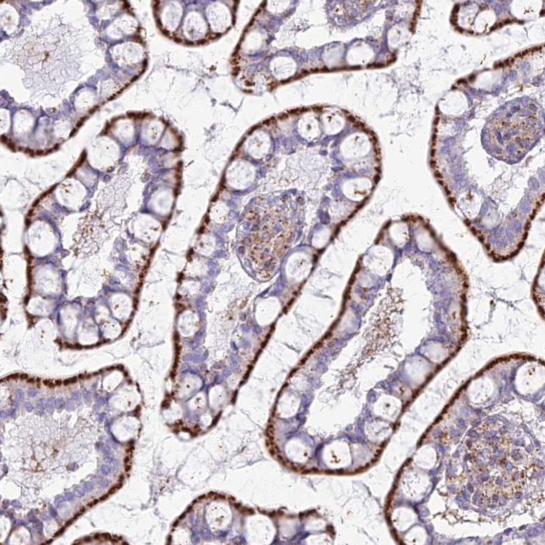 Atlas Antibodies Anti-CHMP4B Antibody