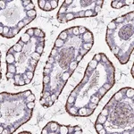 Atlas Antibodies Anti-CHMP4B Antibody