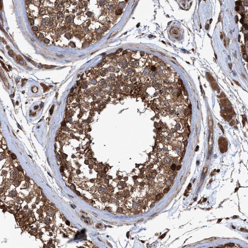 Atlas Antibodies Anti-CHMP6 Antibody