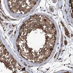 Atlas Antibodies Anti-CHMP6 Antibody