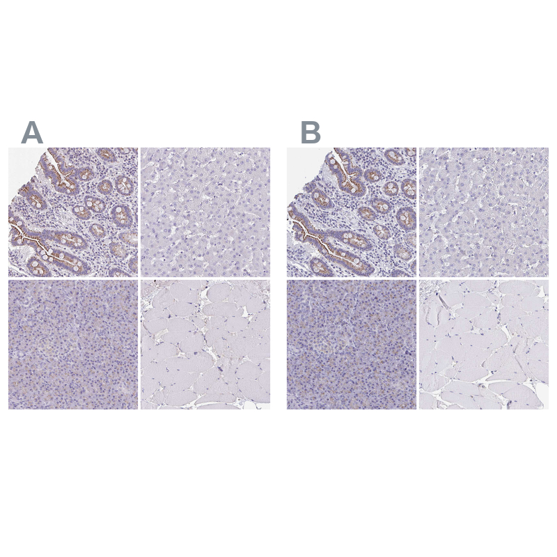Atlas Antibodies Anti-CHMP5 Antibody