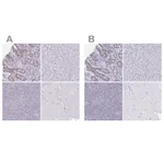 Atlas Antibodies Anti-CHMP5 Antibody